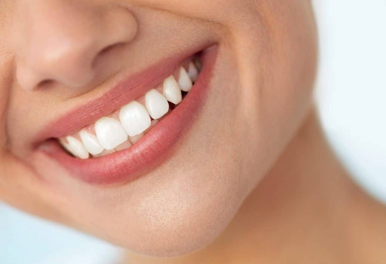Beberapa Cara Menjaga Kesehatan Gigi Anda